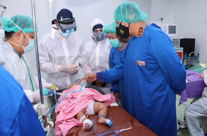  Polda Sumsel Lakukan Operasi Sumbing terhadap Puluhan Warga Palembang